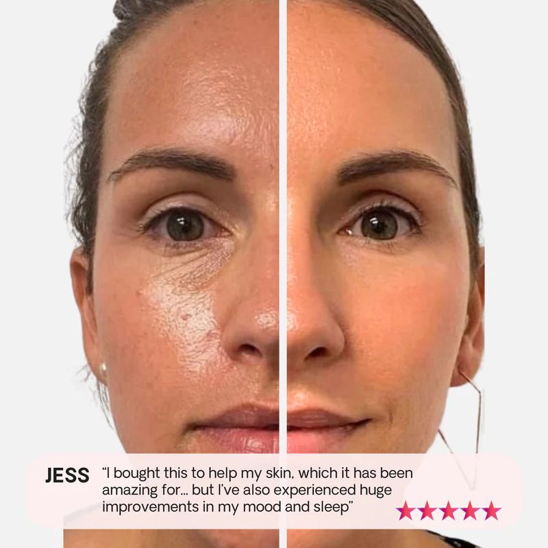 Red Light Therapy Panel With Stand & Near-Infrared