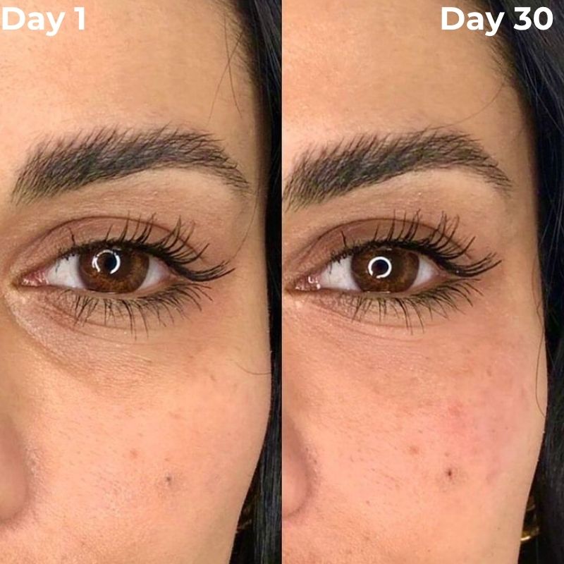 Under Eye Red Light Therapy Device