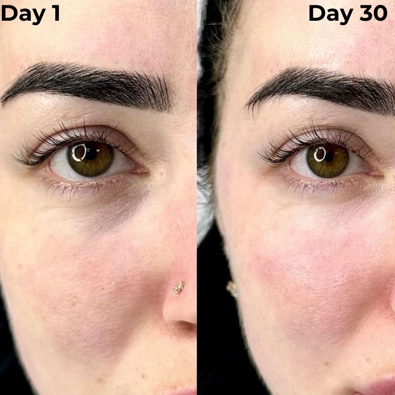 Under Eye Red Light Therapy Device