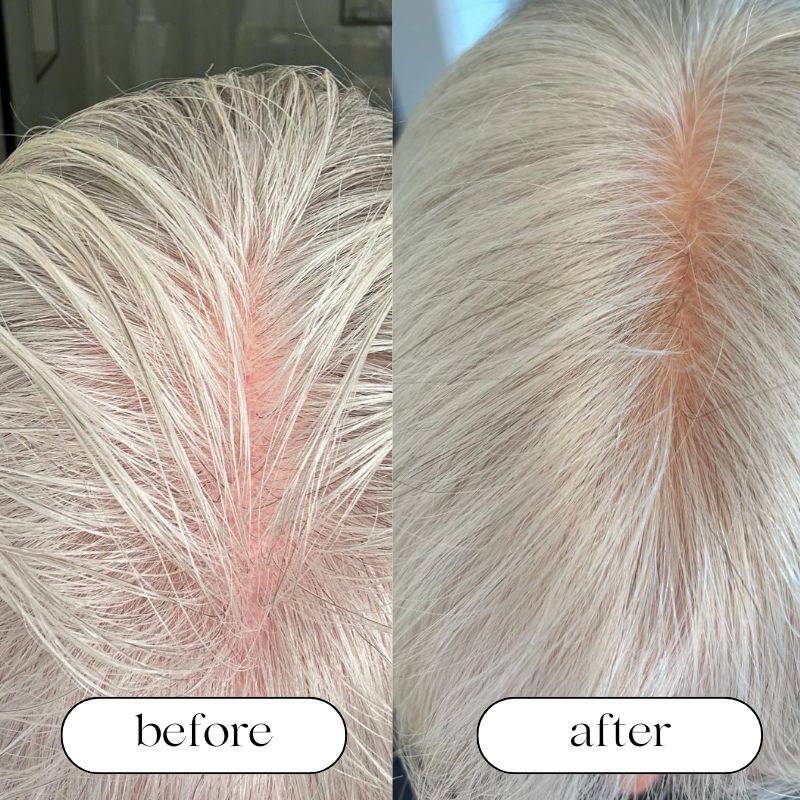 Red Light Therapy Cap for Hair Growth