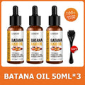 Hair Growth Serum & Derma Roller Bundle