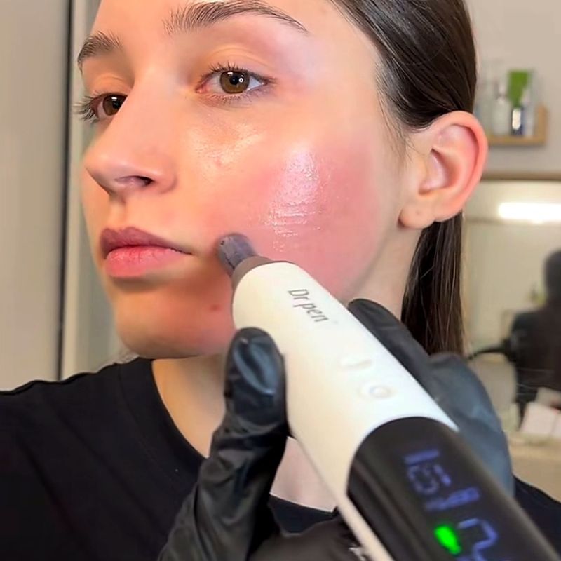 Dr Pen M9 Microneedling Pen